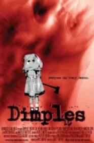 Dimples