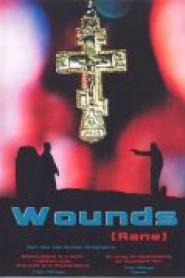 The Wounds