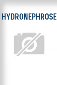 Hydronephrose